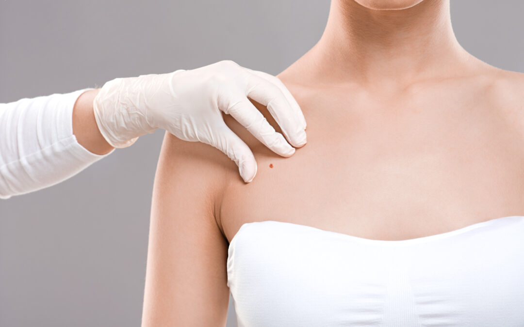 Fayetteville, GA Dermatologists