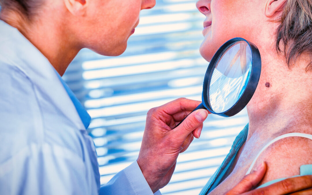 Stockbridge GA Dermatologists
