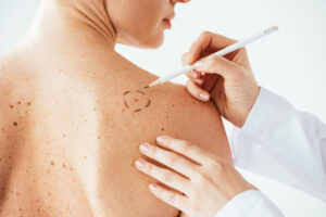 dermatologists for skin cancer screening Atlanta, GA